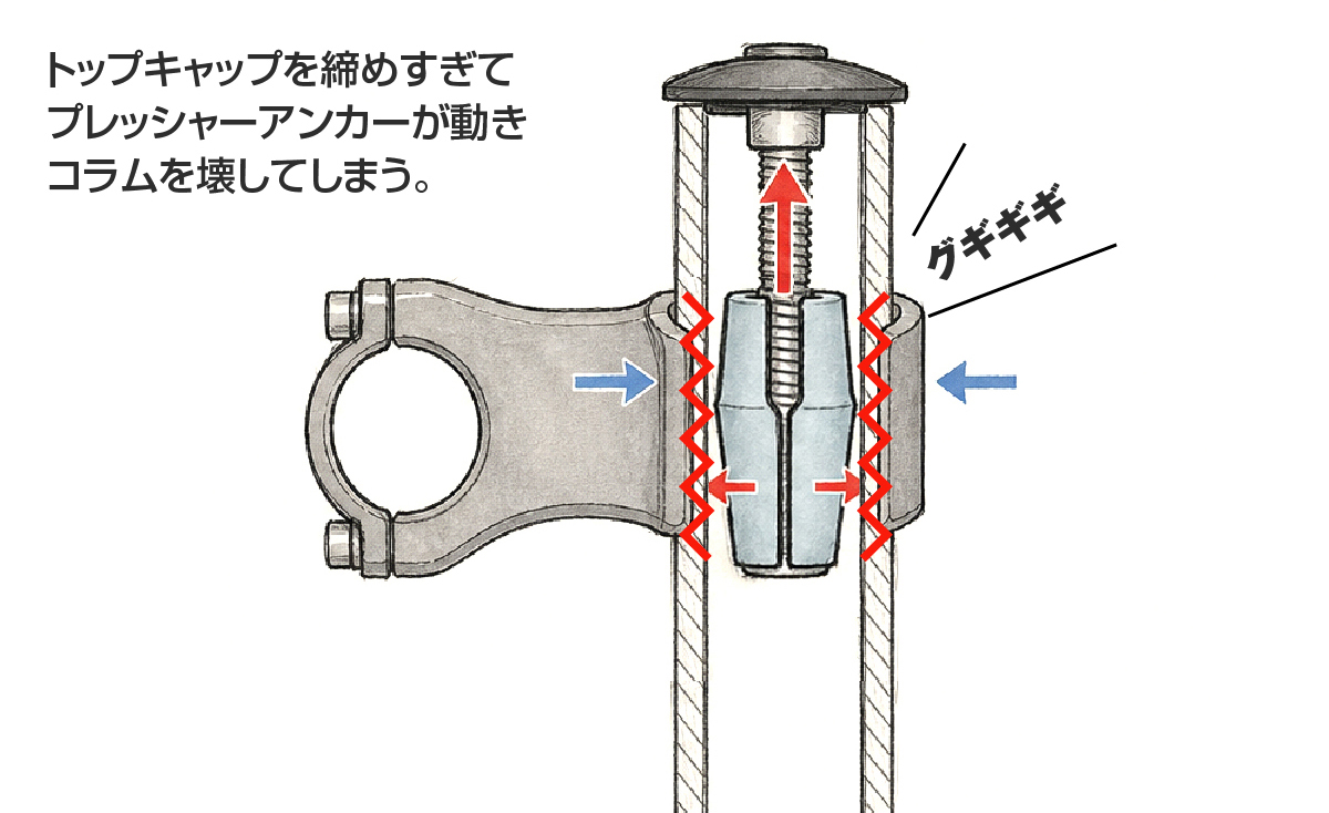 トップキャップの締めすぎでプレッシャーアンカーが動き、カーボンコラムに力がかかるイメージ図